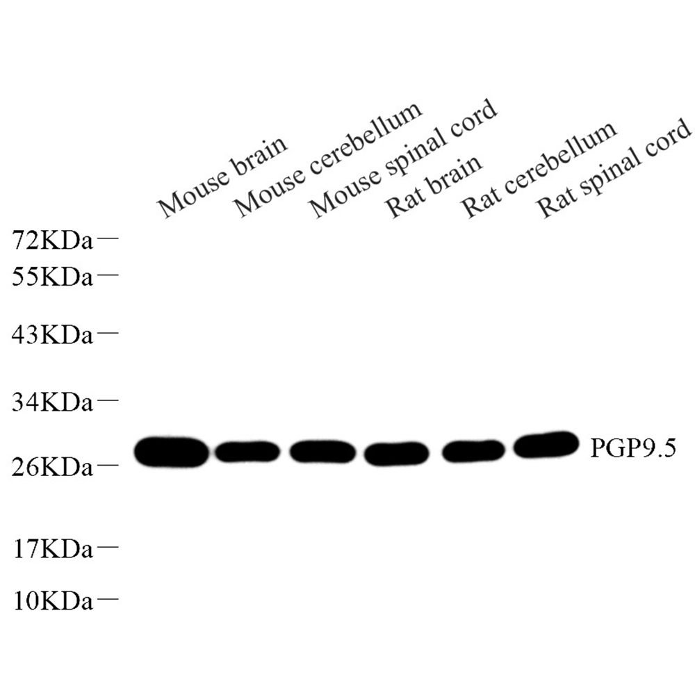 GB11159 polyklonal Anti -PGP9.5 Kaninchen PAB