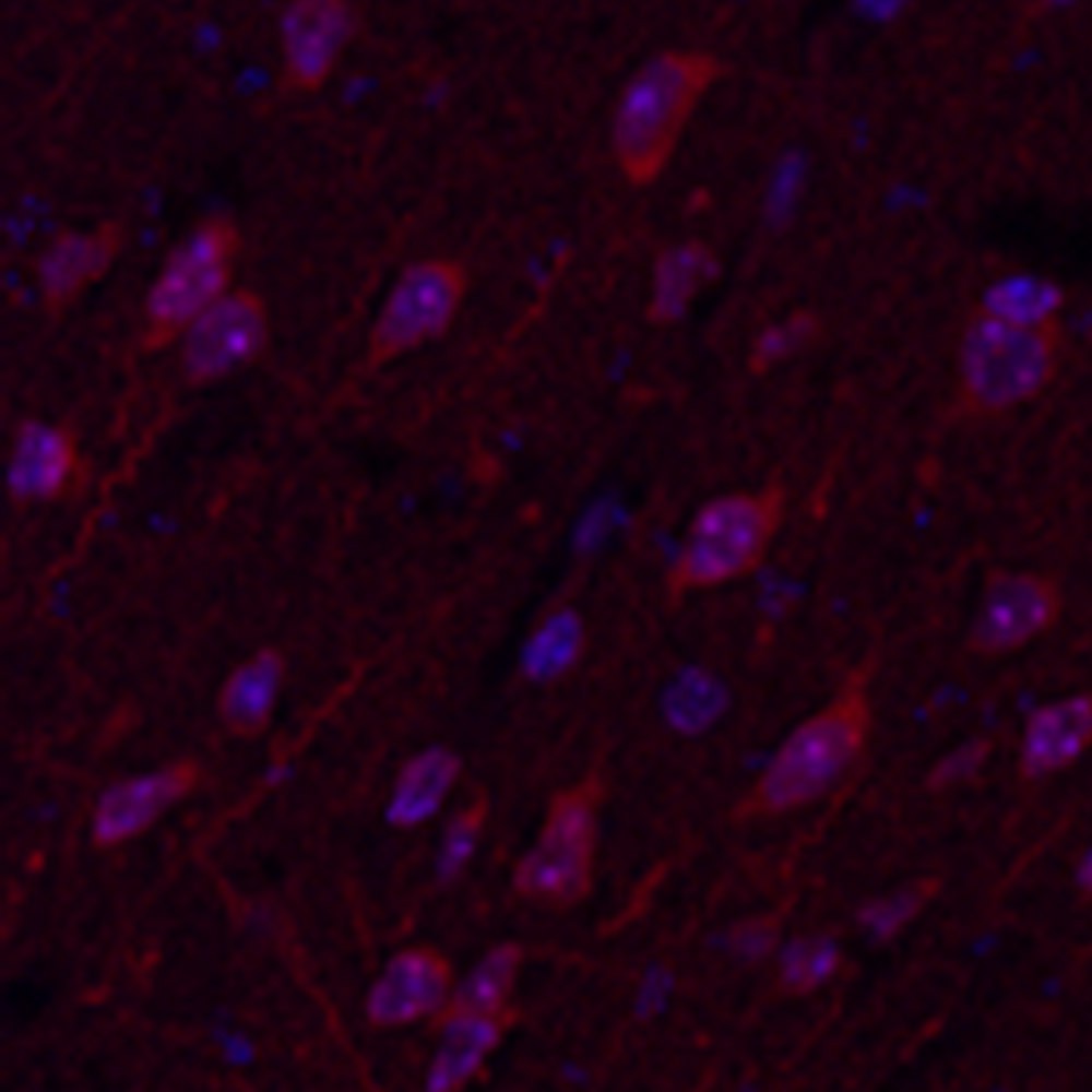 Anti -ngf-Kaninchen-PAB IHC, wenn ein polyklonaler Antikörper