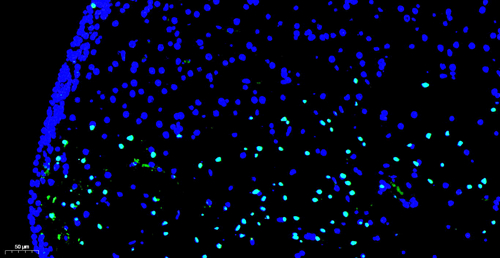 Fluorescein (FITC) TUNELL ZELLEN APOPTOSE Detektion Kit für Paraffinabschnitt gefrorene Gewebeabschnitt Zellen Slide Zellenabstrich