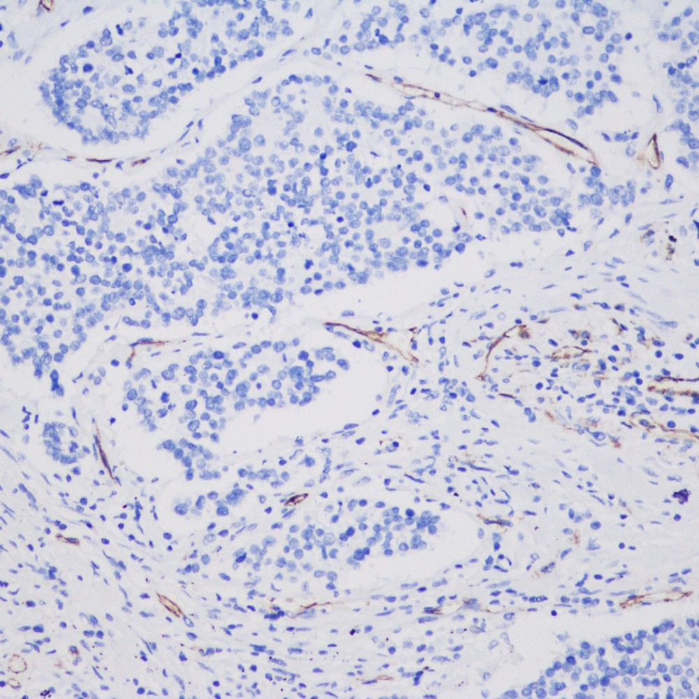 Anti -CD31 Kaninchen-PAB-polyklonaler Antikörper