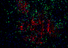 TSA-Fluoreszenz-Doppelfärbungsset-Tyramidsignal-Amplifikation Immunfluoreszenzreagenz