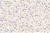 GB11181 Anti-Tylosin Hydroxylase Kaninchen PAB