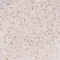 //rkrorwxhrkjnlk5q-static.micyjz.com/cloud/lmBpjKnjlkSRqiqpimloiq/695e1d9a2874c601a0ca67e1ab0779d8-60-60.jpg