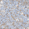 //jnrorwxhrkjnlk5q-static.micyjz.com/cloud/loBpjKnjlkSRqippnjkoiq/1611365430831031935-60-60.jpg