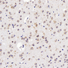 Anti-GDNF-Kaninchen-PAB Immunhistochemischer polyklonaler Antikörper
